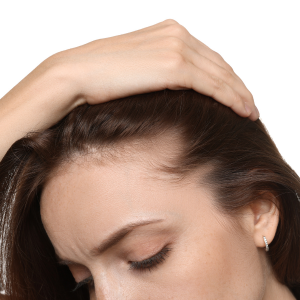 Scalp Micropigmentation Newcastle